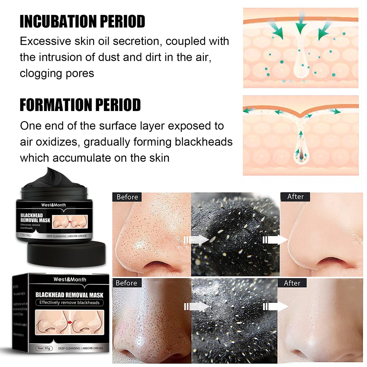 West & Month Blackhead Removal Mask, Peel Off Remove Blackhead Activated Carbon Cleansing Face Mask